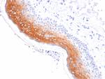 Cytokeratin 1 (Suprabasal Keratinocyte Marker) Antibody in Immunohistochemistry (Paraffin) (IHC (P))