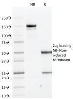 Cytokeratin 1 (Suprabasal Keratinocyte Marker) Antibody in SDS-PAGE (SDS-PAGE)