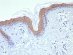 Cytokeratin 1 (Suprabasal Keratinocyte Marker) Antibody in Immunohistochemistry (Paraffin) (IHC (P))