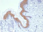 Cytokeratin 1 (Suprabasal Keratinocyte Marker) Antibody in Immunohistochemistry (Paraffin) (IHC (P))