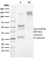 Cytokeratin 3 (KRT3) (Corneal Epithelial Marker) Antibody in SDS-PAGE (SDS-PAGE)