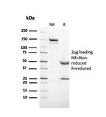 Cytokeratin 3 (KRT3) (Corneal Epithelial Marker) Antibody in SDS-PAGE (SDS-PAGE)