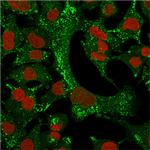 Cytokeratin 4 (KRT4) Antibody in Immunocytochemistry (ICC/IF)