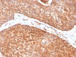 Cytokeratin 5 (KRT5) Antibody in Immunohistochemistry (Paraffin) (IHC (P))