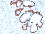 Cytokeratin 5 (KRT5) Antibody in Immunohistochemistry (Paraffin) (IHC (P))