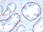 Cytokeratin 5 (KRT5) Antibody in Immunohistochemistry (Paraffin) (IHC (P))