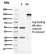 Cytokeratin 5 (KRT5) Antibody in SDS-PAGE (SDS-PAGE)