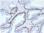 Cytokeratin 5 (KRT5) (Basal, Myoepithelial and MesothelialCellMarker) Antibody in Immunohistochemistry (Paraffin) (IHC (P))