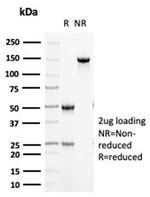 Cytokeratin 5 (KRT5) (Basal, Myoepithelial and MesothelialCellMarker) Antibody in SDS-PAGE (SDS-PAGE)