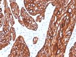 Cytokeratin 5 (KRT5) Antibody in Immunohistochemistry (Paraffin) (IHC (P))