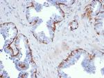 Cytokeratin 5 (KRT5) Antibody in Immunohistochemistry (Paraffin) (IHC (P))