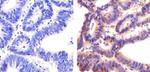 SOCS1 Antibody in Immunohistochemistry (Paraffin) (IHC (P))