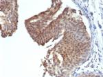 Cytokeratin 6 (KRT6) (Basal Cell Marker) Antibody in Immunohistochemistry (Paraffin) (IHC (P))