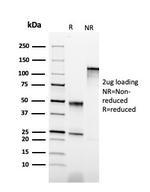 Cytokeratin 6B (KRT6B) (Basal Cell Marker) Antibody in SDS-PAGE (SDS-PAGE)