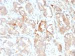 Cytokeratin 6B (KRT6B) (Basal Cell Marker) Antibody in Immunohistochemistry (Paraffin) (IHC (P))