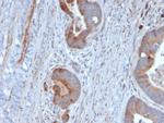 Cytokeratin 6B (KRT6B) (Basal Cell Marker) Antibody in Immunohistochemistry (Paraffin) (IHC (P))