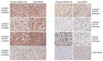 SMAD1 Antibody in Immunohistochemistry (Paraffin) (IHC (P))