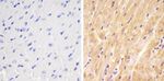 SMAD1 Antibody in Immunohistochemistry (Paraffin) (IHC (P))