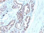 Cytokeratin 7 (Glandular and Transitional Epithelial Marker) Antibody in Immunohistochemistry (Paraffin) (IHC (P))