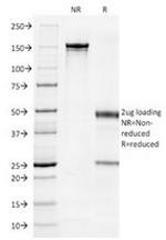 Cytokeratin 7 (Glandular and Transitional Epithelial Marker) Antibody in SDS-PAGE (SDS-PAGE)