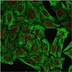 Cytokeratin 7 (Glandular and Transitional Epithelial Marker) Antibody in Immunocytochemistry (ICC/IF)