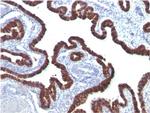 Cytokeratin 7 (Glandular and Transitional Epithelial Marker) Antibody in Immunohistochemistry (Paraffin) (IHC (P))