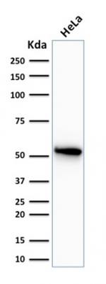 Cytokeratin 7 (Glandular and Transitional Epithelial Marker) Antibody in Western Blot (WB)