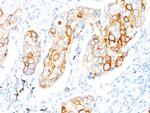 Cytokeratin 7 (Glandular and Transitional Epithelial Marker) Antibody in Immunohistochemistry (Paraffin) (IHC (P))