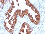 Cytokeratin 7 (Glandular and Transitional Epithelial Marker) Antibody in Immunohistochemistry (Paraffin) (IHC (P))