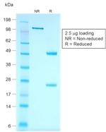 Cytokeratin 7 (Glandular and Transitional Epithelial Marker) Antibody in SDS-PAGE (SDS-PAGE)