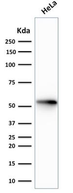 Cytokeratin 7 (Glandular and Transitional Epithelial Marker) Antibody in Western Blot (WB)