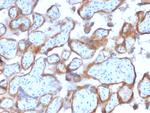 Cytokeratin 7 (Glandular and Transitional Epithelial Marker) Antibody in Immunohistochemistry (Paraffin) (IHC (P))