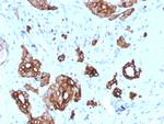 Cytokeratin 7 (Glandular and Transitional Epithelial Marker) Antibody in Immunohistochemistry (Paraffin) (IHC (P))