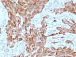 Cytokeratin 7 (Glandular and Transitional Epithelial Marker) Antibody in Immunohistochemistry (Paraffin) (IHC (P))