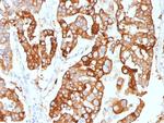 Cytokeratin 7 (Glandular and Transitional Epithelial Marker) Antibody in Immunohistochemistry (Paraffin) (IHC (P))