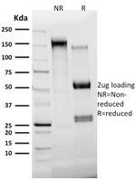 Cytokeratin 7 (Glandular and Transitional Epithelial Marker) Antibody in SDS-PAGE (SDS-PAGE)