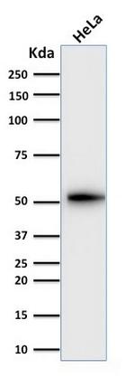 Cytokeratin 7 (Glandular and Transitional Epithelial Marker) Antibody in Western Blot (WB)