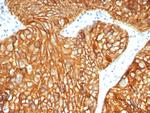 Cytokeratin 7 (Glandular and Transitional Epithelial Marker) Antibody in Immunohistochemistry (Paraffin) (IHC (P))