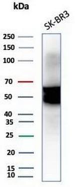 Cytokeratin 7 (Glandular and Transitional Epithelial Marker) Antibody in Western Blot (WB)