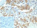 Cytokeratin 7 (Glandular and Transitional Epithelial Marker) Antibody in Immunohistochemistry (Paraffin) (IHC (P))