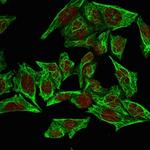 Cytokeratin 7 (Glandular and Transitional Epithelial Marker) Antibody in Immunocytochemistry (ICC/IF)