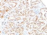 Cytokeratin 7 (Glandular and Transitional Epithelial Marker) Antibody in Immunohistochemistry (Paraffin) (IHC (P))