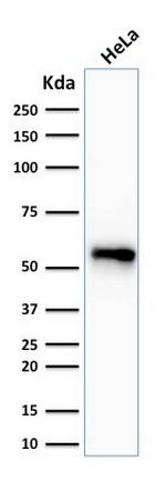 Cytokeratin 7 (Glandular and Transitional Epithelial Marker) Antibody in Western Blot (WB)