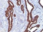 Cytokeratin 7 (Glandular and Transitional Epithelial Marker) Antibody in Immunohistochemistry (Paraffin) (IHC (P))