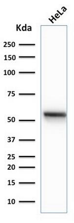 Cytokeratin 7 (Glandular and Transitional Epithelial Marker) Antibody in Western Blot (WB)