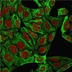 Cytokeratin 7 (Glandular and Transitional Epithelial Marker) Antibody in Immunocytochemistry (ICC/IF)