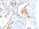 Cytokeratin 7 (Glandular and Transitional Epithelial Marker) Antibody in Immunohistochemistry (Paraffin) (IHC (P))