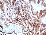 Cytokeratin 7 (Glandular and Transitional Epithelial Marker) Antibody in Immunohistochemistry (Paraffin) (IHC (P))