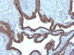 Cytokeratin 7 (Glandular and Transitional Epithelial Marker) Antibody in Immunohistochemistry (Paraffin) (IHC (P))