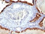 Cytokeratin 7 (Glandular and Transitional Epithelial Marker) Antibody in Immunohistochemistry (Paraffin) (IHC (P))